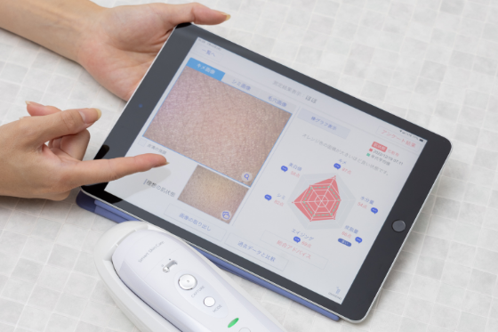 iPas 解析-専用機器でキメ・水分・毛穴・シミを徹底チェック。今の肌状態を「見える化」。